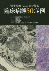 腎生検からここまで解る臨床病態50症例