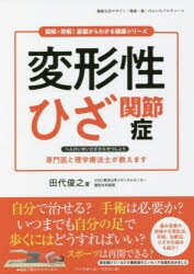 変形性ひざ関節症 専門医と理学療法士が教えます