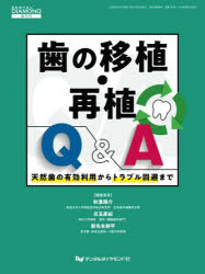 歯の移植・再植Q＆A 天然歯の有効利用からトラブル回避まで