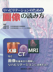 リハビリテーションのための画像の読み方