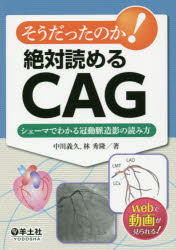 中川義久／著 林秀隆／著本詳しい納期他、ご注文時はご利用案内・返品のページをご確認ください出版社名羊土社出版年月2016年04月サイズ155P 21cmISBNコード9784758107563医学 臨床医学内科系 循環器一般そうだったのか!絶対読めるCAG シェーマでわかる冠動脈造影の読み方ソウダツタ ノカ ゼツタイ ヨメル シ-エ-ジ- シエ-マ デ ワカル カンドウミヤク ゾウエイ ノ ヨミカタ※ページ内の情報は告知なく変更になることがあります。あらかじめご了承ください登録日2016/03/25