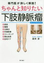 ちゃんと知りたい下肢静脈瘤 専門医が詳しく解説!