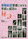 骨粗鬆症患者に対する手術と成功の秘訣