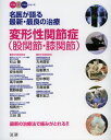 名医が語る最新・最良の治療 変形性関節症〈股関節・膝関節〉 最新の治療法で痛みがとれる!!