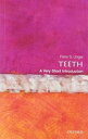 OPB VSI: Teeth #384
