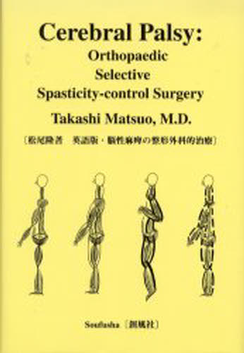 脳性麻痺の整形外科的治療 Cerebral palsy Orthopaedic selective spasticity‐control surgery 英語版