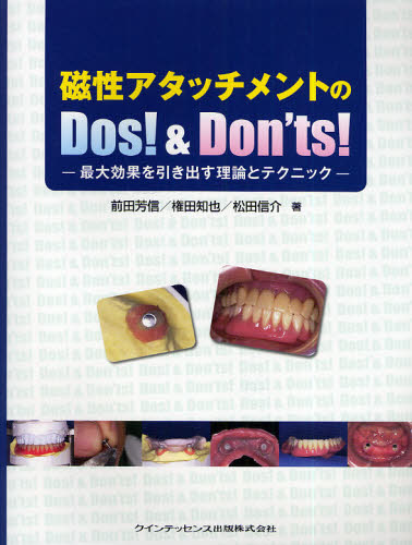 Dentistry - 磁性アタッチメントのDos!＆Don’ts! 最大効果を引き出す理論とテクニック