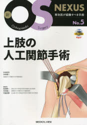 上肢の人工関節手術