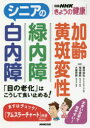 シニアの白内障 緑内障 加齢黄斑変性 「目の老化」はこうして食い止める!