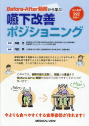Before‐After動画から学ぶ嚥下改善ポジショニング