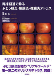 臨床経過で診る ぶどう膜炎・網膜炎・強膜炎アトラス [ 後藤 浩 ]