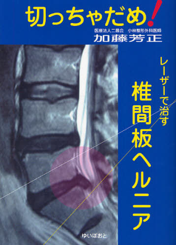 切っちゃだめ レーザーで治す椎間板ヘルニア