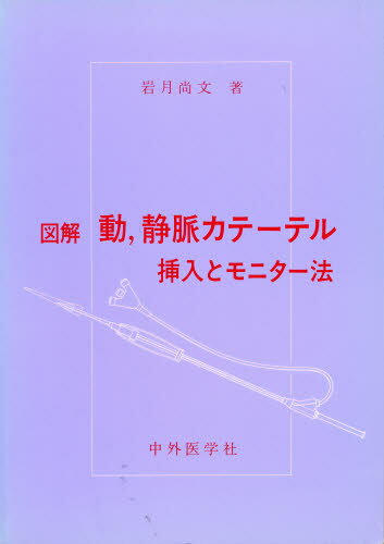 図解 動、静脈カテーテル 挿入とモニター