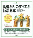 食道がんのすべてがわかる本 イラスト版
