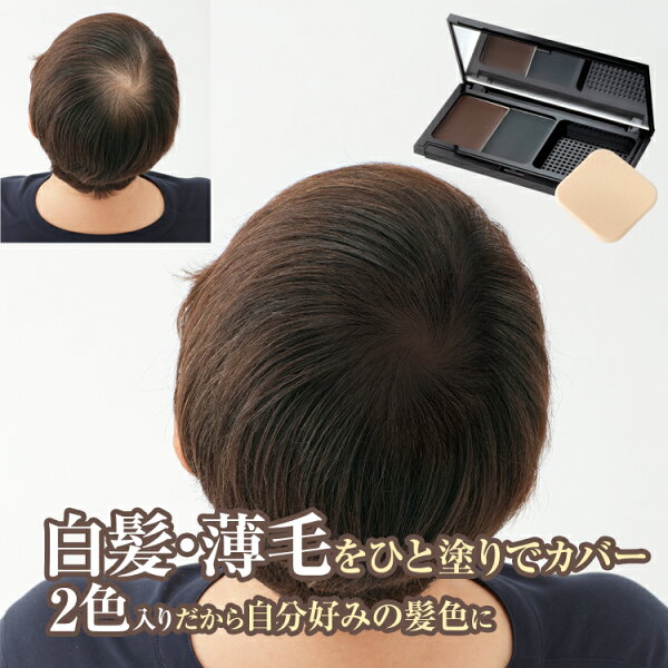 ヘアファンデーション 円形脱毛症 みんな探してる人気モノ ヘアファンデーション 円形脱毛症 美容 コスメ 香水 ヘアファンデーション 円形脱毛症 みんな探してる人気モノ ヘアファンデーション 円形脱毛症 美容 コスメ 香水