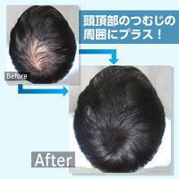 つむじ周辺にプラス 増毛くんシリーズ つむじくん 人毛100 ファーストセット付き 初回購入限定 マイクロファイバー付き 一回のみ ヘアダイレクト 店 ヘアケア スタイリング かつら 頭頂部の薄毛部分を増毛 シール式なので 誰でも簡単に装着 つむじ周辺にプラス 増毛くんシリーズ つむじくん 人毛100 ファーストセット付き 初回購入限定 マイクロファイバー付き 一回のみ ヘアダイレクト 店 ヘアケア スタイリング かつら 頭頂部の薄毛部分を増毛 シール式なので 誰でも簡単に装着