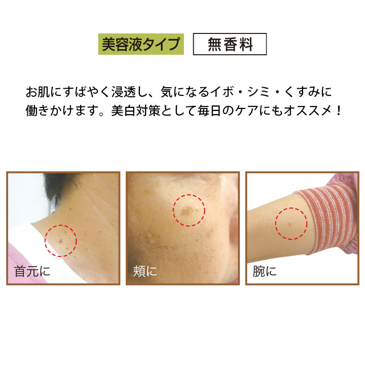 【老人性ゆうぜい専用美容液】ナチュレ ポロン [Z0016] イボ しみ くすみ 美白 対策 フェイス スキン ケア 敬老の日 ギフト プレゼント 誕生日 スキンケア 美容 美容液 ヨクイニン halekipa-10000352 Halekipa(ハレキパ) サンプル画像3