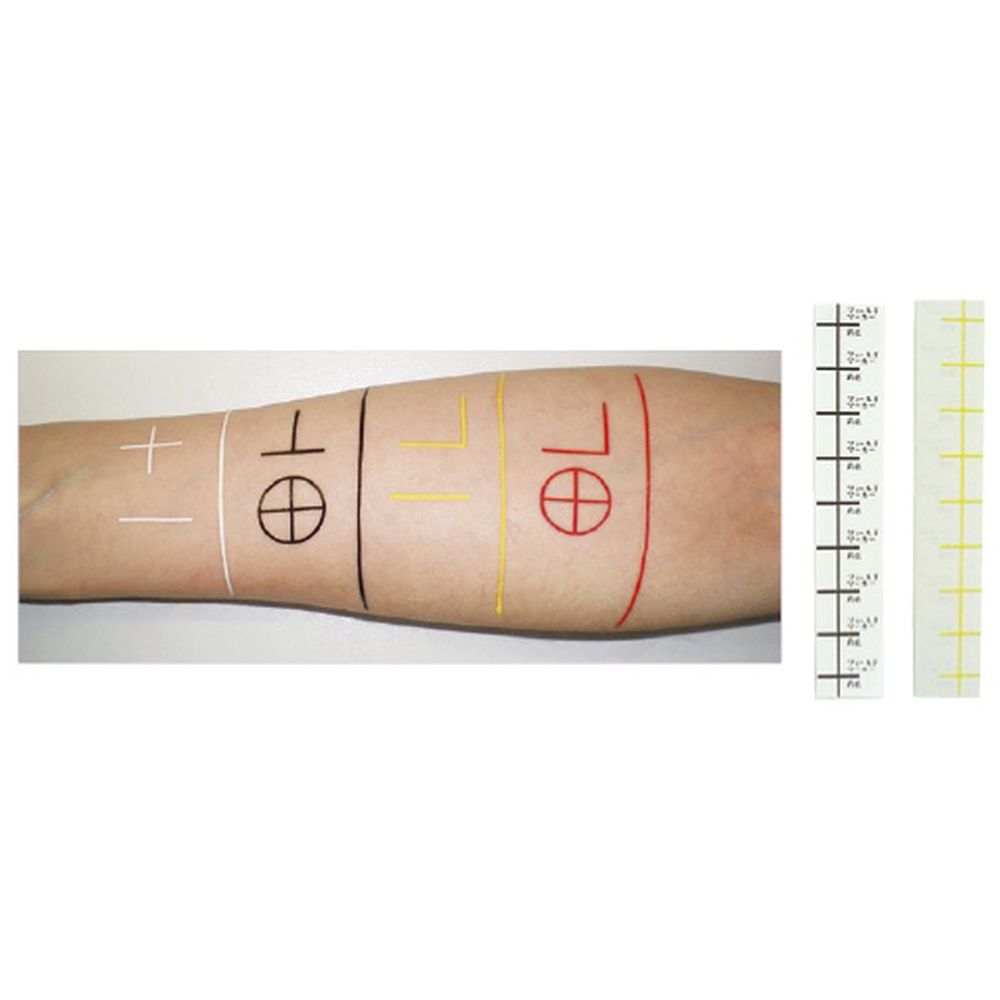 【★ポイント5倍★】10/4~10/9開催！お買い物マラソン(要エントリー) 松吉医科器械 放射線治療用フィールドマーカー 黄 コーナーL（90チップ） 1箱 中部メディカル 23-2663-0303　販売セット入数：1