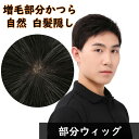 部分かつら 男性用 天頂部用 黒 短い 通気性 高品質 ヘアピース 部分ウィッグ メンズ 軽量 人毛 トップカバー 薄毛 脱毛 増毛部分かつら 白髪隠し 増毛部分ウィッグ 医療用 抗がん剤治療 増毛 敬老の日 ブラック全頭カバー 全頭ウィッグ 分け目 超自然 春 夏 秋 冬