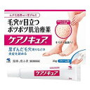 【第2類医薬品】【2個セット】小林製薬 ケアノキュア 20g (4987072045824-2)【メール便発送】