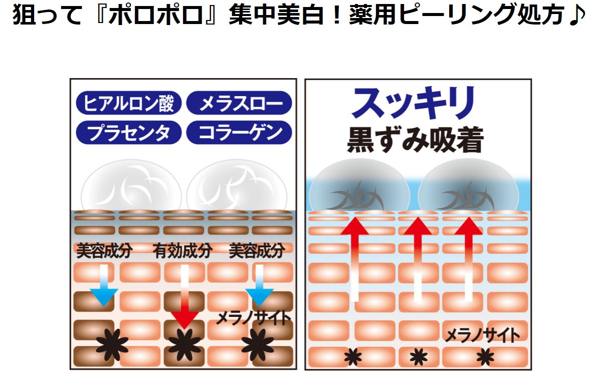 【送料無料】薬用 シミーポロン 30g 【医薬部外品】頑固なシミ肌対策にオススメです♪ シミーポロン 美白 美容 シミ そばかすを防ぐ 美白パック 黒ずみ くすみ 対策 予防 スキンケア 美白 クリーム シミ取りクリーム 日焼け ピーリング