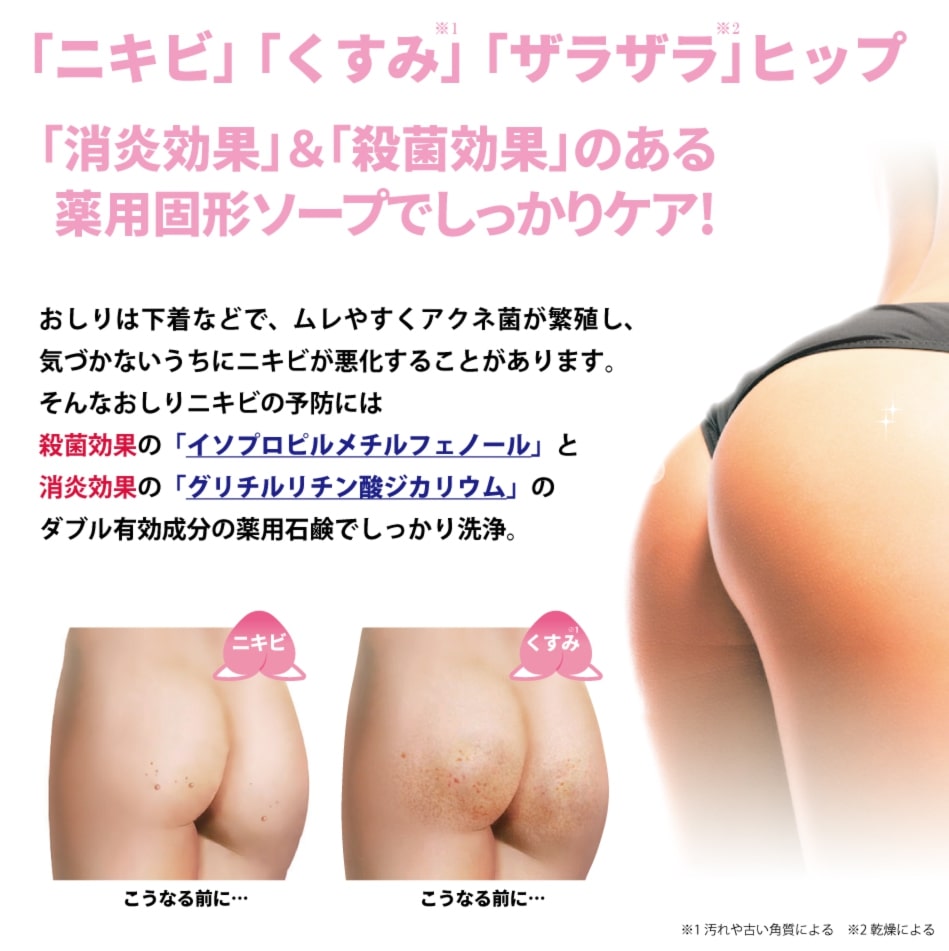 【送料無料】NEW 魅惑のおしり アクネソープ 80g×6個セット 【医薬部外品】「ニキビ」「くすみ」「ザラザラ」ヒップに消炎＆殺菌効果の薬用固形ソープでしっかりケア♪ お尻 ニキビ 黒ずみ おしり ニキビケア ニキビ にきび クリーム ニキビ跡 色素沈着 消し 対策 2