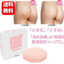 【送料無料】NEW 魅惑のおしり アクネソープ 80g 【医薬部外品】「ニキビ」「くすみ」「ザラザラ」ヒップに消炎&殺菌効果の薬用固形ソープでしっかりケア♪ お...