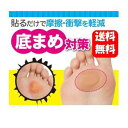 【送料無料】簡単貼るだけ クッション付き底まめガードテープ 貼るだけで摩擦・衝撃を軽減!簡単底まめ対策グッズ♪ 足裏 底まめ 底豆 保護クッション 衝撃吸収 足の裏 底まめ 保護パッド テープ 底マメテープ 足裏シート 足裏サポーター ランニング マメ あしのうら 足