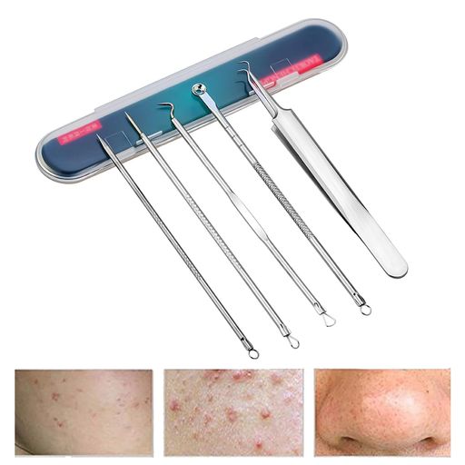 nalaina角栓取り【5本セット】ニキビ取り毛抜き毛穴ケア専用キット黒ずみ取りニキビ針抗菌ステンレス携帯便利収納ケース付き美容ツール美容用品