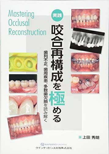 楽天Haute Produit【中古】 実践 咬合再構成を極める: 歯列不正、歯周疾患、多数歯欠損を読み解く