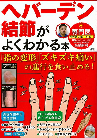 Medicine, Pharmacy - 【中古】 ヘバーデン結節がよくわかる本 「指の変形」「ズキズキ痛い」の進行を食い止める! (TJMOOK)