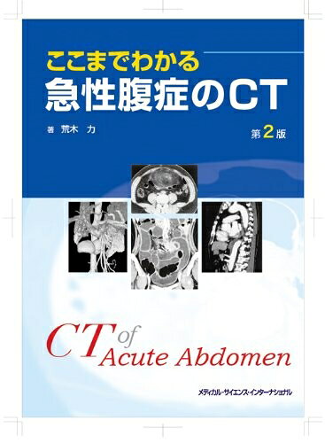 【お届け日について】お届け日の"指定なし"で、記載の最短日より早くお届けできる場合が多いです。お品物をなるべく早くお受け取りしたい場合は、お届け日を"指定なし"にてご注文ください。お届け日をご指定頂いた場合、ご注文後の変更はできかねます。【お品物お届けまでの流れについて】・ご注文：24時間365日受け付けております。・ご注文の確認と入金：入金*が完了いたしましたらお品物の手配をさせていただきます・お届け：商品ページにございます最短お届け日数±3日前後でのお届けとなります。*前払いやお支払いが遅れた場合は入金確認後配送手配となります、ご理解くださいますようお願いいたします。【中古品の不良対応について】・お品物に不具合がある場合、到着より7日間は返品交換対応*を承ります。初期不良がございましたら、購入履歴の「ショップへお問い合わせ」より不具合内容を添えてご連絡ください。*代替え品のご提案ができない場合ご返金となりますので、ご了承ください。・お品物販売前に動作確認をしておりますが、中古品という特性上配送時に問題が起こる可能性もございます。お手数おかけいたしますが、お品物ご到着後お早めにご確認をお願い申し上げます。【在庫切れ等について】弊社は他モールと併売を行っている兼ね合いで、在庫反映システムの処理が遅れてしまい在庫のない商品が販売中となっている場合がございます。完売していた場合はメールにてご連絡いただきますの絵、ご了承ください。【重要】当社中古品は、製品を利用する上で問題のないものを取り扱っております。ご安心して、ご購入いただければ幸いです。・中古本の特性上【ヤケ、破れ、折れ、メモ書き、匂い、レンタル落ち】等がある場合がございます。・レンタル落ちの場合、タグ等が張り付いている場合がございますが、使用する上で問題があるものではございません。・商品名に【付属、特典、○○付き、ダウンロードコード】等の記載があっても中古品の場合は基本的にこれらは付属致しません。下記メーカーインフォになりますため、保証等の記載がある場合がございますが、こちらの製品は中古品ですのでメーカー保証の対象外となります。あらかじめご了承下さい。また、掲載されております画像は全てイメージとなります。実際の商品とは色味等異なる場合がございますので、ご了承ください。ここまでわかる急性腹症のCT 第2版【急性腹症診断になくてはならない“頼れる味方”、待望の最新版】●急性腹症の診断においてCTをいかに活用すべきか、代表的かつ教育的な症例を提示しつつ解説したロングセラーの改訂版。●疾患ごとにまず症例写真、続いてその画像に関する所見を提示、それを踏まえた上でいかなる診断を下し治療方針を導き出すか、診療のプロセスに従い簡明に解説。●加えてそれぞれの疾患の解説や“キーポイント”、重要事項を総括したBOX“ノート”が適宜配置されている。●改版にともない、急性腹症の診断におけるCTの必要性、有用性を改めて説いた章と新たに51症例を追加、内容の充実が図られる。●放射線科医、救急医はもとより腹部の急性疾患を診る機会のある全ての臨床家、研修医必読の書。