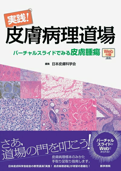 【中古】 実践! 皮膚病理道場 バーチャルスライドでみる皮膚腫瘍 [Web付録付]