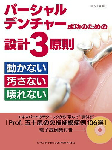 【中古】 パーシャルデンチャー成功のための設計3原則　動かない 汚さない 壊れない