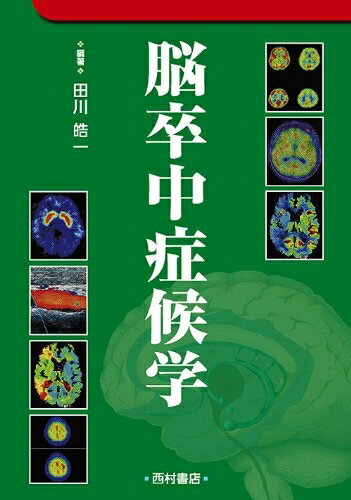【中古】 脳卒中症候学