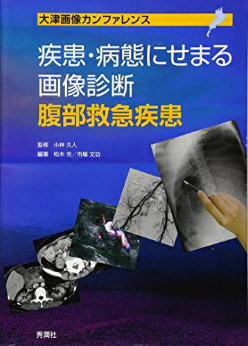 【中古】 疾患・病態にせまる画像診断 腹部救急疾患 (大津画像カンファレンス)