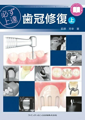 【中古】 必ず上達 歯冠修復(上)