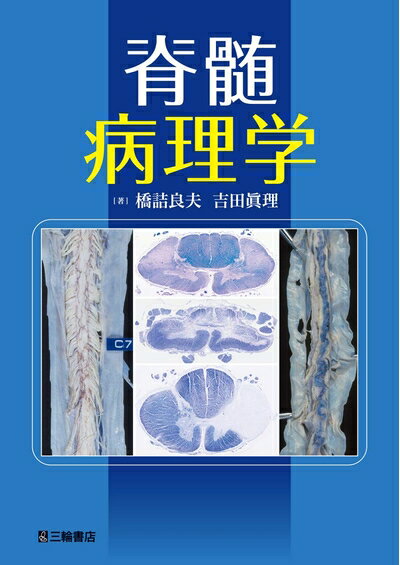 【中古】 脊髄病理学