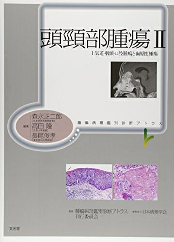 【お届け日について】お届け日の"指定なし"で、記載の最短日より早くお届けできる場合が多いです。お品物をなるべく早くお受け取りしたい場合は、お届け日を"指定なし"にてご注文ください。お届け日をご指定頂いた場合、ご注文後の変更はできかねます。【要注意事項】掲載されておりますお写真画像は全てイメージとなり、お送りするものを保証するものではございませんので、必ず下記事項を一読ください。【お品物お届けまでの流れについて】・ご注文：24時間365日受け付けております。・ご注文の確認と入金：入金*が完了いたしましたらお品物の手配をさせていただきます・お届け：商品ページにございます最短お届け日数±3日前後でのお届けとなります。*前払いやお支払いが遅れた場合は入金確認後配送手配となります、ご理解くださいますようお願いいたします。【中古品の不良対応について】・お品物に不具合がある場合、到着より7日間は返品交換対応*を承ります。初期不良がございましたら、購入履歴の「ショップへお問い合わせ」より不具合内容を添えてご連絡ください。*代替え品のご提案ができない場合ご返金となりますので、ご了承ください。・お品物販売前に動作確認をしておりますが、中古品という特性上配送時に問題が起こる可能性もございます。お手数おかけいたしますが、お品物ご到着後お早めにご確認をお願い申し上げます。【在庫切れ等について】弊社は他モールと併売を行っている兼ね合いで、在庫反映システムの処理が遅れてしまい在庫のない商品が販売中となっている場合がございます。完売していた場合はメールにてご連絡いただきますの絵、ご了承ください。【重要】・当社中古品は、製品を利用する上で問題のないものを取り扱っておりますので、ご安心して、ご購入いただければ幸いです。・商品の画像及びシリアルナンバーを弊社の方で控えておりますので、すり替え・模造品対策店舗として安心してお買い求めください。・中古本の特性上【ヤケ、破れ、折れ、メモ書き、匂い、レンタル落ち】等がある場合がございます。・レンタル落ちの場合、タグ等が張り付いている場合がございますが、使用する上で問題があるものではございません。・商品名に【付属、特典、○○付き、ダウンロードコード】等の記載があっても中古品の場合は基本的にこれらは付属致しません。下記はメーカーインフォになりますため、保証等の記載がある場合や、付属品詳細の記載がある場合がございますが、こちらの製品は中古品ですのでメーカー保証の対象外となり、付属品に関しましても、製品の機能として損なわない付属品（保存袋、ストラップ...ect）は基本的には付属いたしません。かならずご理解いただいた上で、ご購入ください。頭頚部腫瘍 (2) (腫瘍病理鑑別診断アトラス)