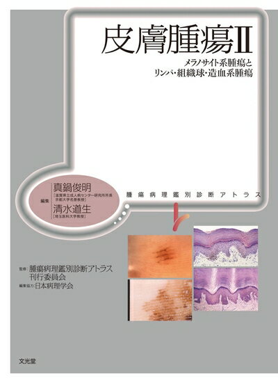 【中古】 皮膚腫瘍 (2) (腫瘍病理鑑別診断アトラス)