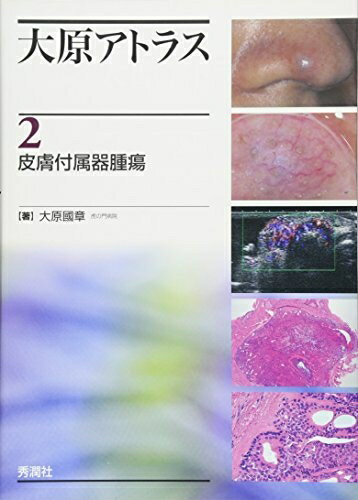 楽天市場】皮膚付属器腫瘍アトラスの通販 楽天市場】皮膚付属器腫瘍アトラスの通販