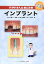 【中古】 科学が生んだ歯の治療 インプラント 最新版