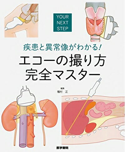 【中古】 疾患と異常像がわかる! エコーの撮り方 完全マスター