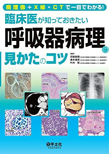 【お届け日について】お届け日の"指定なし"で、記載の最短日より早くお届けできる場合が多いです。お品物をなるべく早くお受け取りしたい場合は、お届け日を"指定なし"にてご注文ください。お届け日をご指定頂いた場合、ご注文後の変更はできかねます。【要注意事項】掲載されておりますお写真画像は全てイメージとなり、お送りするものを保証するものではございませんので、必ず下記事項を一読ください。【お品物お届けまでの流れについて】・ご注文：24時間365日受け付けております。・ご注文の確認と入金：入金*が完了いたしましたらお品物の手配をさせていただきます・お届け：商品ページにございます最短お届け日数±3日前後でのお届けとなります。*前払いやお支払いが遅れた場合は入金確認後配送手配となります、ご理解くださいますようお願いいたします。【中古品の不良対応について】・お品物に不具合がある場合、到着より7日間は返品交換対応*を承ります。初期不良がございましたら、購入履歴の「ショップへお問い合わせ」より不具合内容を添えてご連絡ください。*代替え品のご提案ができない場合ご返金となりますので、ご了承ください。・お品物販売前に動作確認をしておりますが、中古品という特性上配送時に問題が起こる可能性もございます。お手数おかけいたしますが、お品物ご到着後お早めにご確認をお願い申し上げます。【在庫切れ等について】弊社は他モールと併売を行っている兼ね合いで、在庫反映システムの処理が遅れてしまい在庫のない商品が販売中となっている場合がございます。完売していた場合はメールにてご連絡いただきますの絵、ご了承ください。【重要】・当社中古品は、製品を利用する上で問題のないものを取り扱っておりますので、ご安心して、ご購入いただければ幸いです。・商品の画像及びシリアルナンバーを弊社の方で控えておりますので、すり替え・模造品対策店舗として安心してお買い求めください。・中古本の特性上【ヤケ、破れ、折れ、メモ書き、匂い、レンタル落ち】等がある場合がございます。・レンタル落ちの場合、タグ等が張り付いている場合がございますが、使用する上で問題があるものではございません。・商品名に【付属、特典、○○付き、ダウンロードコード】等の記載があっても中古品の場合は基本的にこれらは付属致しません。下記はメーカーインフォになりますため、保証等の記載がある場合や、付属品詳細の記載がある場合がございますが、こちらの製品は中古品ですのでメーカー保証の対象外となり、付属品に関しましても、製品の機能として損なわない付属品（保存袋、ストラップ...ect）は基本的には付属いたしません。かならずご理解いただいた上で、ご購入ください。病理像＋X線・CTで一目でわかる！ 臨床医が知っておきたい呼吸器病理の見かたのコツ