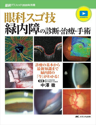 【中古】 眼科スゴ技 緑内障の診断・治療・手術:...の商品画像