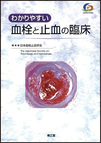 【お届け日について】お届け日の"指定なし"で、記載の最短日より早くお届けできる場合が多いです。お品物をなるべく早くお受け取りしたい場合は、お届け日を"指定なし"にてご注文ください。お届け日をご指定頂いた場合、ご注文後の変更はできかねます。【要注意事項】掲載されておりますお写真画像は全てイメージとなり、お送りするものを保証するものではございませんので、必ず下記事項を一読ください。【お品物お届けまでの流れについて】・ご注文：24時間365日受け付けております。・ご注文の確認と入金：入金*が完了いたしましたらお品物の手配をさせていただきます・お届け：商品ページにございます最短お届け日数±3日前後でのお届けとなります。*前払いやお支払いが遅れた場合は入金確認後配送手配となります、ご理解くださいますようお願いいたします。【中古品の不良対応について】・お品物に不具合がある場合、到着より7日間は返品交換対応*を承ります。初期不良がございましたら、購入履歴の「ショップへお問い合わせ」より不具合内容を添えてご連絡ください。*代替え品のご提案ができない場合ご返金となりますので、ご了承ください。・お品物販売前に動作確認をしておりますが、中古品という特性上配送時に問題が起こる可能性もございます。お手数おかけいたしますが、お品物ご到着後お早めにご確認をお願い申し上げます。【在庫切れ等について】弊社は他モールと併売を行っている兼ね合いで、在庫反映システムの処理が遅れてしまい在庫のない商品が販売中となっている場合がございます。完売していた場合はメールにてご連絡いただきますの絵、ご了承ください。【重要】・当社中古品は、製品を利用する上で問題のないものを取り扱っておりますので、ご安心して、ご購入いただければ幸いです。・商品の画像及びシリアルナンバーを弊社の方で控えておりますので、すり替え・模造品対策店舗として安心してお買い求めください。・中古本の特性上【ヤケ、破れ、折れ、メモ書き、匂い、レンタル落ち】等がある場合がございます。・レンタル落ちの場合、タグ等が張り付いている場合がございますが、使用する上で問題があるものではございません。・商品名に【付属、特典、○○付き、ダウンロードコード】等の記載があっても中古品の場合は基本的にこれらは付属致しません。下記はメーカーインフォになりますため、保証等の記載がある場合や、付属品詳細の記載がある場合がございますが、こちらの製品は中古品ですのでメーカー保証の対象外となり、付属品に関しましても、製品の機能として損なわない付属品（保存袋、ストラップ...ect）は基本的には付属いたしません。かならずご理解いただいた上で、ご購入ください。わかりやすい血栓と止血の臨床