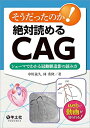 【中古】(新古品・未使用品) そうだったのか! 絶対読めるCAG〜シェーマでわかる冠動脈造影の読み方