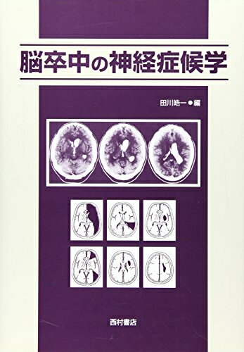 【中古】 脳卒中の神経症候学