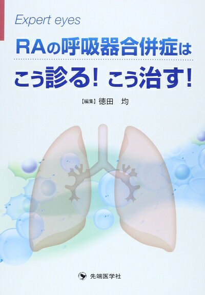  RAの呼吸器合併症はこう診る!こう治す!: Expert eyes