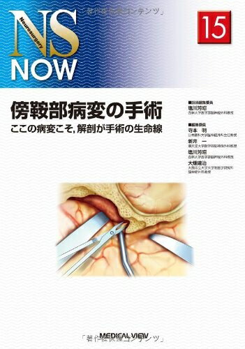 【中古】 傍鞍部病変の手術−ここの病変こそ,解剖が手術の生命線 (NS NOW No.15)